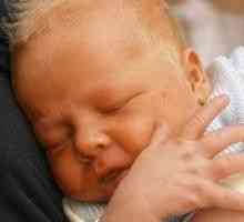 Norma bilirubin pri novorojenčkih
