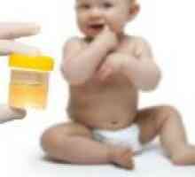 Norme urina pri odraslih, pri otrocih