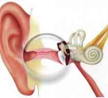 Akutno vnetje srednjega ušesa - v povprečju, gnojen, katarju, akutno vnetje srednjega ušesa pri…