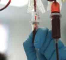 Transfuzijo krvi iz vene v zadnjico