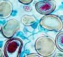 Perfuzijska - metoda oskrbe biološkem tkivu