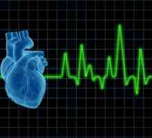 Pomoč v kardiogeni šok