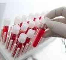 Zmanjšana hitrost sedimentacije eritrocitov v krvi pri ženskah, razloge