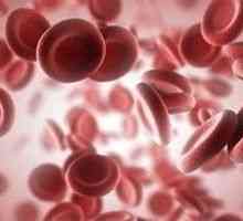 Znižane hematokrit, vzroki in zdravljenje nizkega hematokrita