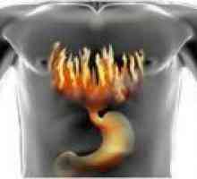 Večja kislost v želodcu: kako ravnati?