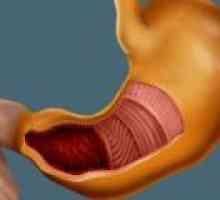 Večja kislost v želodcu: simptomi, diagnosticiranje, zdravljenje