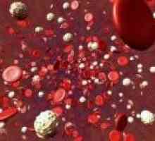 Povečano število trombocitov v krvi