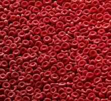 Zvišane rdečih krvničk v krvi