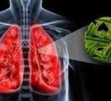 Vzroki za pljučno tuberkulozo