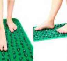 Preprečevanje flatfoot pri otrocih in odraslih