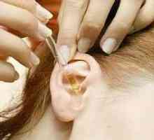 Mozolj na uho: glavni vzroki in zdravljenje
