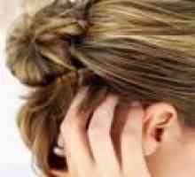 Akne na čelu - kako se znebiti od njih?