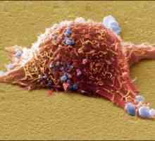 Rak kože: Vrste, Simptomi, metode zdravljenja