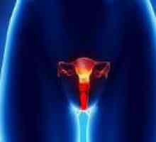 Vulvi raka pri ženskah - vzroki, diagnoza, zdravljenje