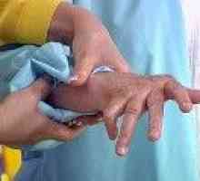 Revmatoidni artritis: zdravljenje sodobnih in tradicionalnih metod