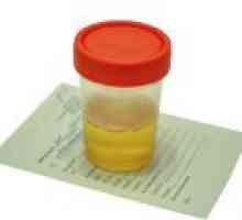 Sladkor v urinu med nosečnostjo, vzrokov, stopnji