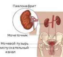 Simptomi kronične pielonefritis pri ženskah, pri moških