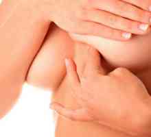 Simptomi in zdravljenje mastitisa pri doječih materah