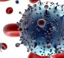 Simptomi okužbe z virusom HIV pri ženskah