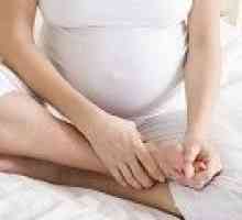 Krči v nogah v času nosečnosti, vzroki, zdravljenje