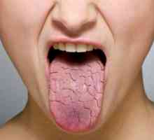 Suha usta - povzroča bolezen