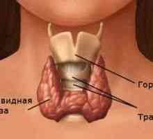 Hashimotov tiroiditis (Hashimotov tiroiditis) - vzroki, simptomi in zdravljenje