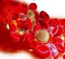 Trombocitopenija: Vzroki, simptomi, zdravljenje