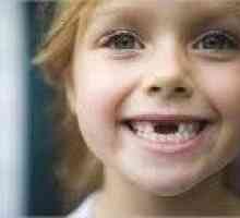 Otrok ne izpade otroške zobe - Vzroki