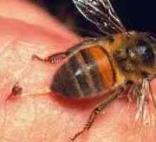 Sting iz čebele, ose, Hornet: Zdravljenje