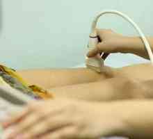 Žilni ultrazvok: kaj se dogaja in kaj potrebujete