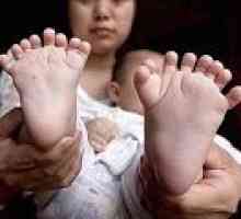 Na Kitajskem se je otrok rodil z 31 prsti