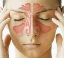 Vnetje sinusov: simptomi, zdravljenje