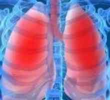 Pljučnica pri odraslih: Simptomi, Zdravljenje
