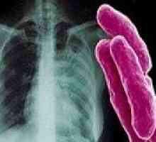 Povzročitelj tuberkuloze. Kako je TB?