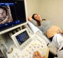 Škodljiva, če ultrazvok med nosečnostjo? Kolikokrat lahko storite?