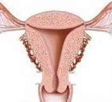 Glandularna hiperplazija endometrija - Vzroki, Zdravljenje