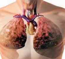 Tekočine v pljuča vzrokov, simptomi, zdravljenje