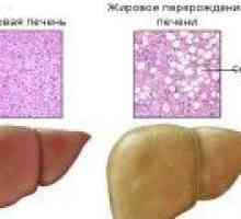 Steatozo jeter: Simptomi in zdravljenje