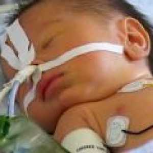 Artreziya požiralnika pri novorojenčkih