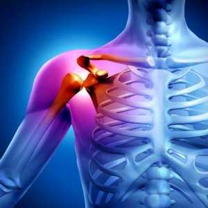 Artritis ramenskega sklepa: Simptomi in zdravljenje