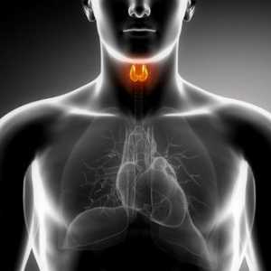 Tiroidni avtoimunski tiroiditis, kakšna je