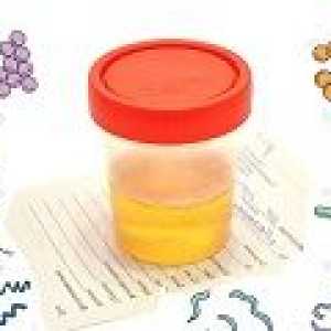 Bakterije v urinu (bakteriurije): vzroki, simptomi, zdravljenje