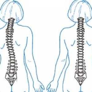 Kaj bo kiropraktik za bolečine v hrbtu?