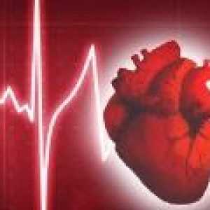 Kaj je motnje srčnega ritma?