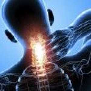 Kaj je artroza unkovertebralny?