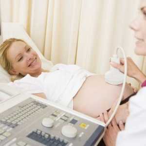 Doppler ultrazvok v nosečnosti - kaj je to?
