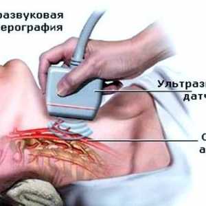 Doppler ultrazvok (ultrazvok) raziskovalna plovila možganov in vratu