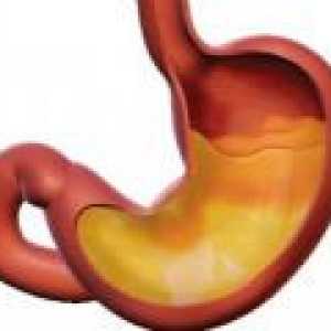 Gastritis z nizko kislost - simptomi, zdravljenje