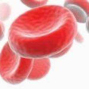 Hipokromna anemija: Vrste in zdravljenje