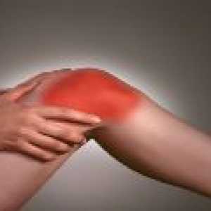 Osteoartritisa kolena: vzroki, zdravljenje